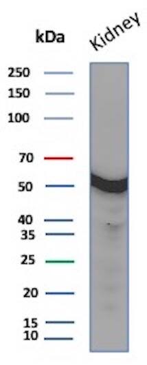 Western blot analysis of Human kidney tissue lysate using Glucose 6 phosphate isomerase Antibody (GPI/2439).