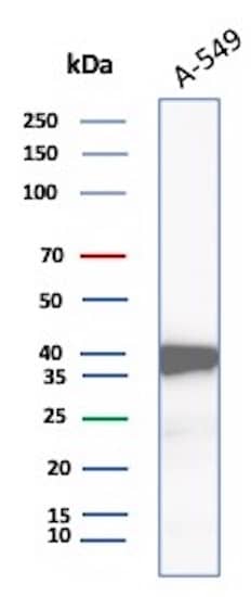 Western Blot Analysis of A-549 lysate using Aldo-keto Reductase 1C1/AKR1C1 Antibody (AKR1C1/9318).