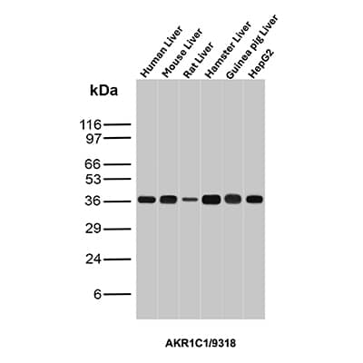 Western blot analysis of (1) human liver, (2) mouse liver, (3) rat liver, (4) hamster liver, (5) guinea pig liver and (6) HepG2 cell lysates using Aldo-keto Reductase 1C1/AKR1C1 Antibody (AKR1C1/9318).