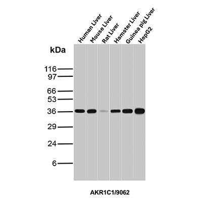 Western blot analysis of (1) human liver, (2) mouse liver, (3) rat liver, (4) hamster liver, (5) guinea pig liver and (6) HepG2 cell lysates using Aldo-keto Reductase 1C1/AKR1C1 Antibody (AKR1C1/9062).