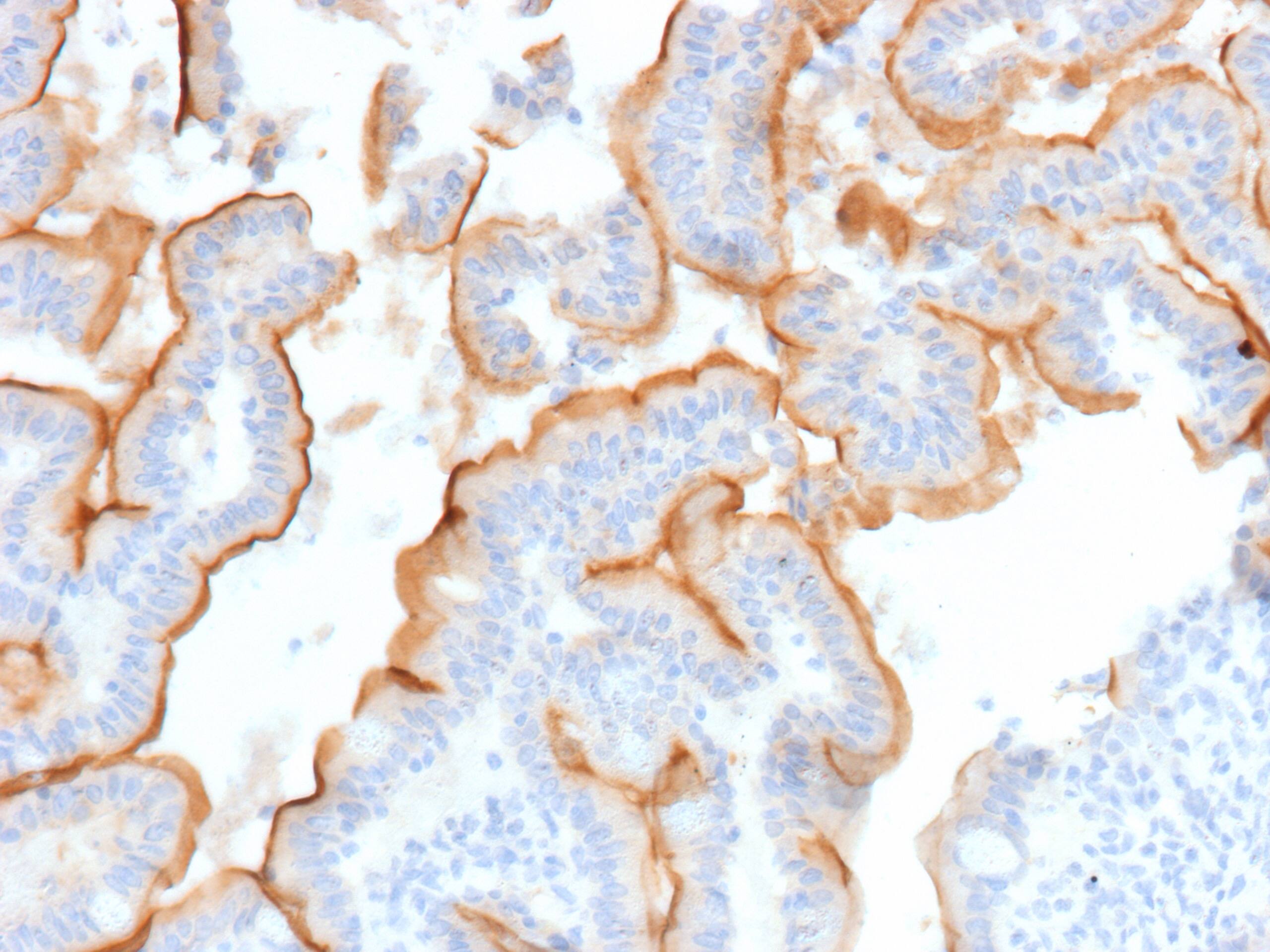 Formalin-fixed, paraffin-embedded human small intestine stained with MUC13 Antibody (MUC13/13112)). HIER: Tris/EDTA, pH9.0, 45min. 2 : HRP-polymer, 30min. DAB, 5min.