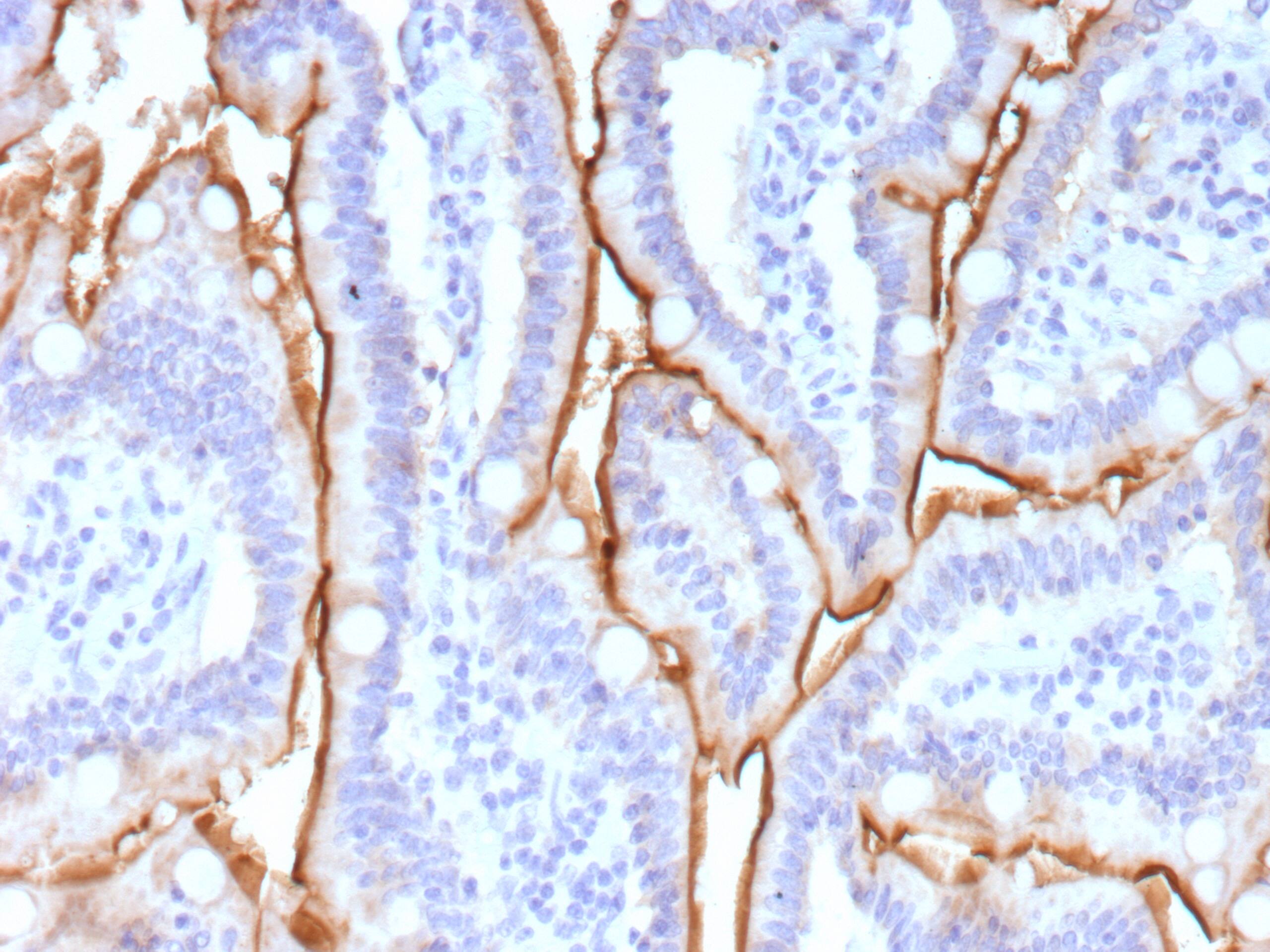 Formalin-fixed, paraffin-embedded human small intestine stained with MUC13 Antibody (MUC13/13113)). HIER: Tris/EDTA, pH9.0, 45min. 2 : HRP-polymer, 30min. DAB, 5min.