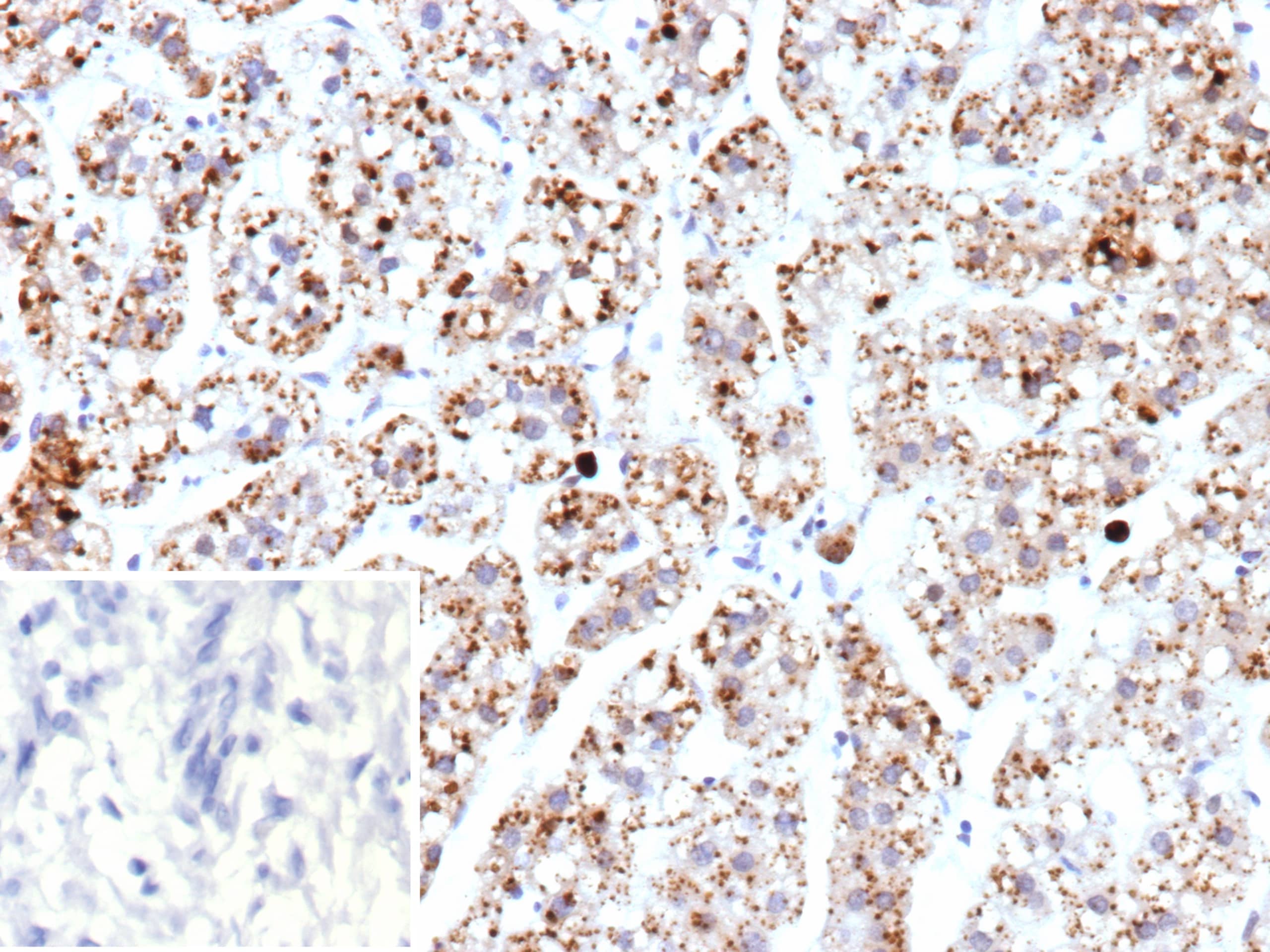 Formalin-fixed, paraffin-embedded human adrenal gland stained with mtTFA Antibody (TFAM/9713). Inset: PBS instead of primary antibody; secondary only negative control.