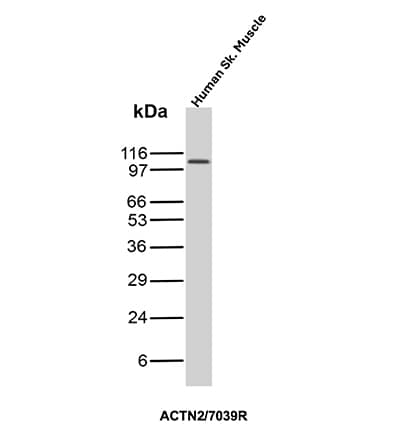 Western blot analysis of Human Skeletal muscle tissue lysate using Alpha Actinin 2 Antibody (ACTN2/7039R).