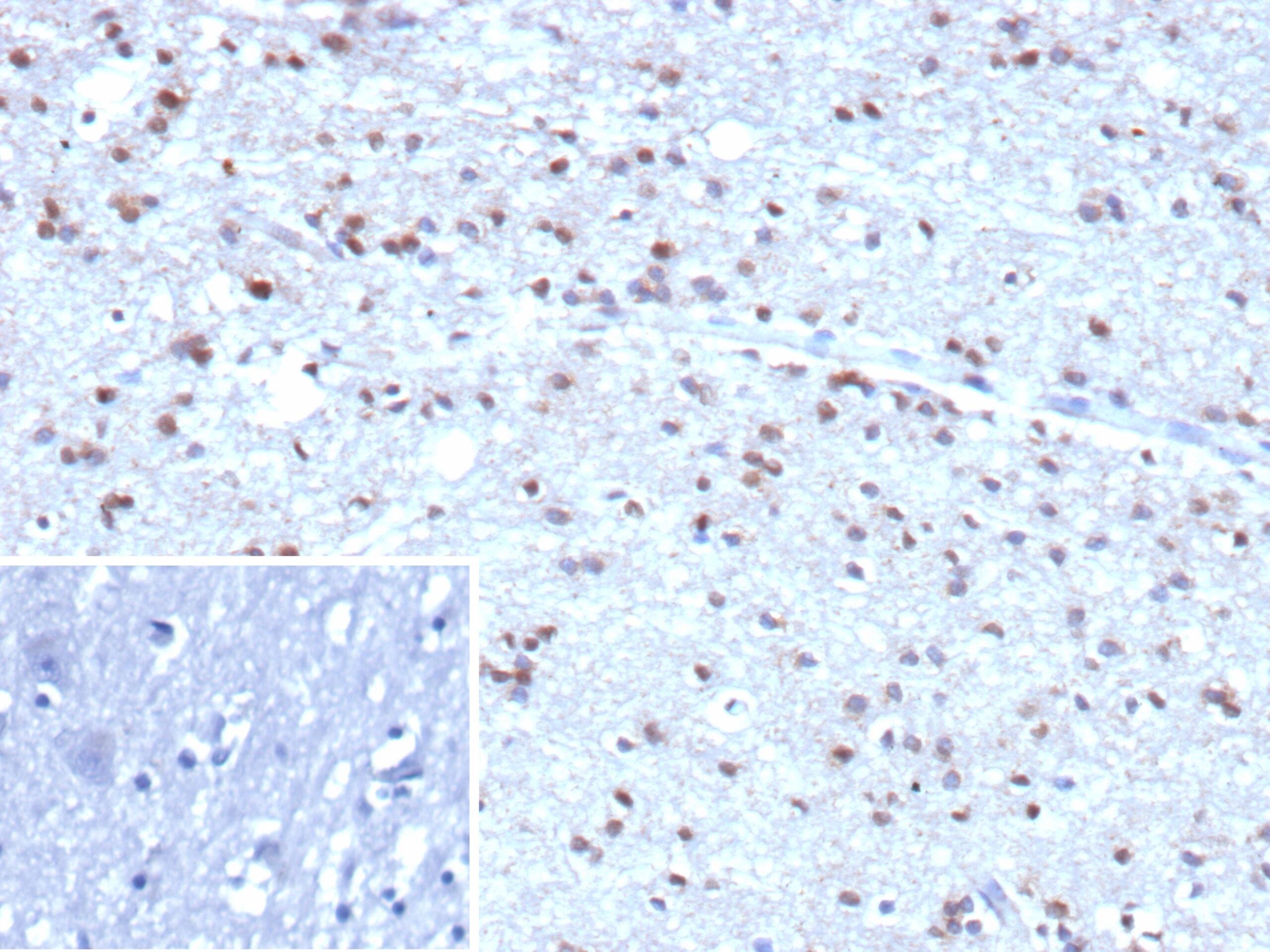 Formalin-fixed, paraffin-embedded human brain stained with Ubiquitin B Antibody (rUBB/9476).Inset: PBS instead of primary antibody; secondary only negative control.