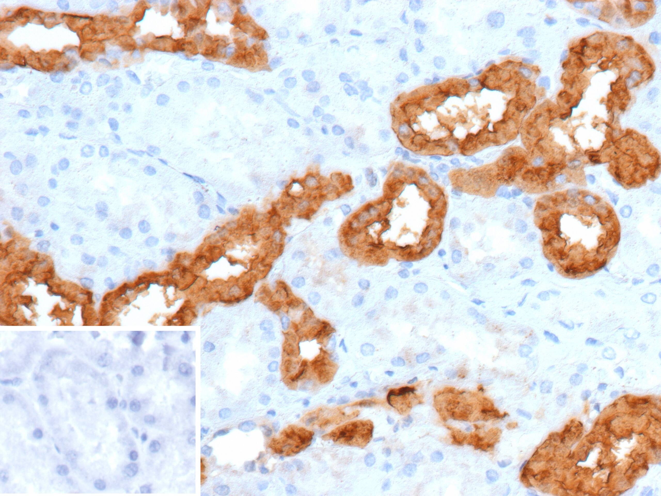 Formalin-fixed, paraffin-embedded human kidney stained with Calbindin D-28K Antibody (rCALB1/13280). Inset: PBS instead of primary antibody; secondary only negative control.