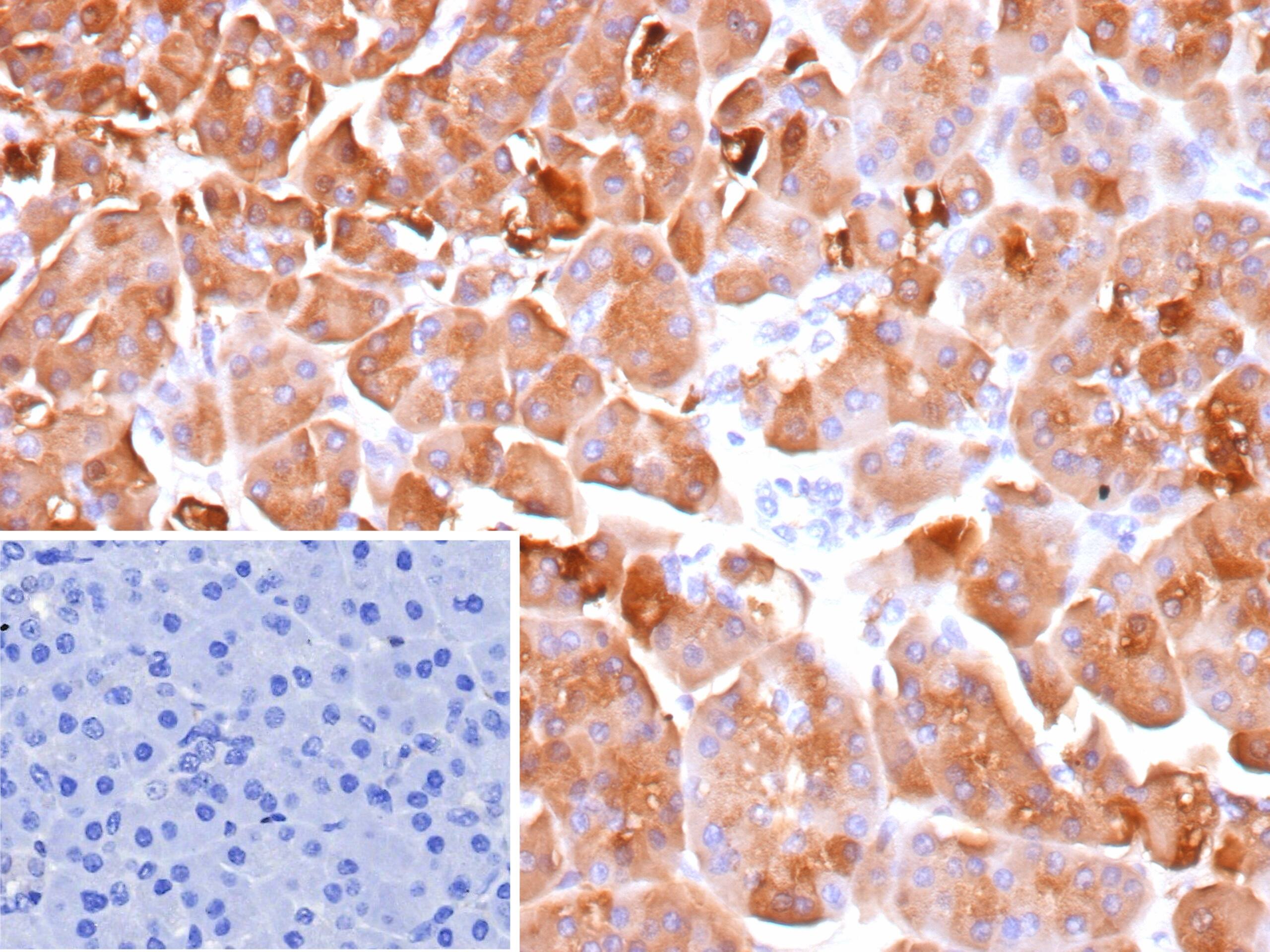 Formalin-fixed, paraffin-embedded human pancreas stained with ELA3A Antibody (CELA3A/12552). Inset: PBS instead of primary antibody; secondary only negative control.