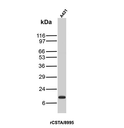 Western Blot Analysis of A431 cell lysate using Cystatin A Antibody (rCSTA/8995).