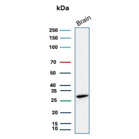 Western blot analysis of human brain tissue lysate using Calbindin D-28K Antibody (rCALB1/13280).