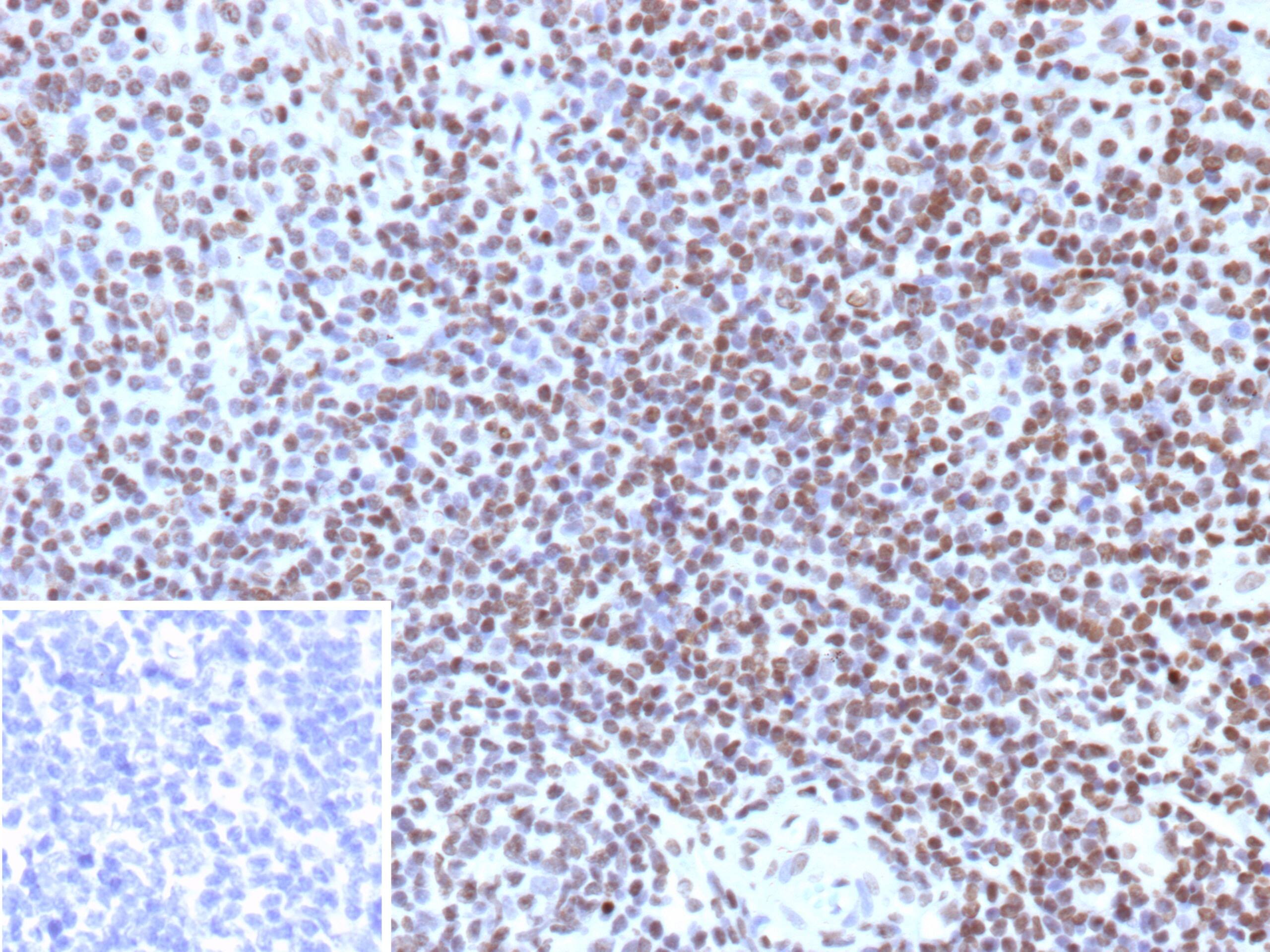 Formalin-fixed, paraffin-embedded human tonsil stained with Histone H3.1 [p Ser10] Antibody (rHH3/9924). Inset: PBS instead of primary antibody; secondary only negative control.