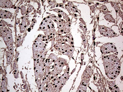 Immunohistochemical staining of paraffin-embedded Human bladder tissue within the normal limits using anti-MEIS1 mouse monoclonal antibody. Heat-induced epitope retrieval by EDTA solution buffer pH 8.0 at 120Â°C for 3 min.