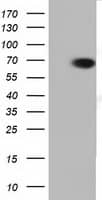 HEK293T cells were transfected with the pCMV6-ENTRY control (Left lane) or pCMV6-ENTRY PEX5 (, Right lane) cDNA for 48 hrs and lysed. Equivalent amounts of cell lysates (5 ug per lane) were separated by SDS-PAGE and immunoblotted with anti-PEX5.