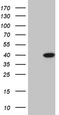 HEK293T cells were transfected with the pCMV6-ENTRY control (Left lane) or pCMV6-ENTRY ERLIN1 (, Right lane) cDNA for 48 hrs and lysed. Equivalent amounts of cell lysates (5 ug per lane) were separated by SDS-PAGE and immunoblotted with anti-ERLIN1 (1:2000). 