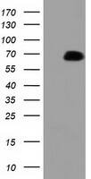 HEK293T cells were transfected with the pCMV6-ENTRY control (Left lane) or pCMV6-ENTRY PEX5 Right lane) cDNA for 48 hrs and lysed. Equivalent amounts of cell lysates (5 ug per lane) were separated by SDS-PAGE and immunoblotted with anti-PEX5. 