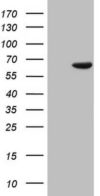 HEK293T cells were transfected with the pCMV6-ENTRY control ( Left lane) or pCMV6-ENTRY PAPSS2 ( Right lane) cDNA for 48 hrs and lysed. Equivalent amounts of cell lysates (5 ug per lane) were separated by SDS-PAGE and immunoblotted with anti-PAPSS2. Positive lysates