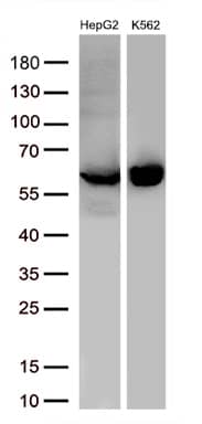 Western blot analysis of extracts (30ug per lane) from 2 different cell lines lysates by using anti-PKLR antibody.