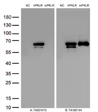 Figure A, Western blot analysis of overexpressed lysates (15ug per lane) from HEK293T cells transfected with empty plasmid (PS100001, NC), human PKLR plasmid (, hPKLR), mouse PKLR plasmid (MR215886, mPKLR) using anti-PKLR antibody (1:10000@1mg/ml). Figure B, Western blot analysis of the same samples as figure A with anti-DDK antibody .