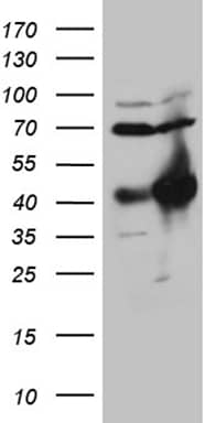 HEK293T cells were transfected with the pCMV6-ENTRY control (Left lane) or pCMV6-ENTRY HOXC4 (, Right lane) cDNA for 48 hrs and lysed. Equivalent amounts of cell lysates (5 ug per lane) were separated by SDS-PAGE and immunoblotted with anti-HOXC4 (1:2000). 