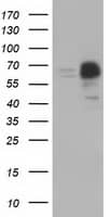 HEK293T cells were transfected with the pCMV6-ENTRY control ( Left lane) or pCMV6-ENTRY PEX5 ( , Right lane) cDNA for 48 hrs and lysed. Equivalent amounts of cell lysates (5 ug per lane) were separated by SDS-PAGE and immunoblotted with anti-PEX5. Positive lysates