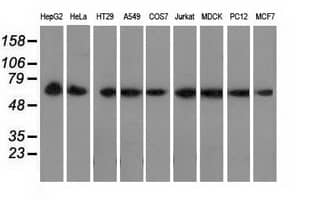 Western blot analysis of extracts (35ug) from 9 different cell lines by using anti-PEX5 monoclonal antibody.