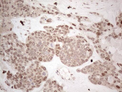 Immunohistochemistry HMGB4 Antibody (OTI5G3)