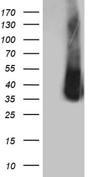 Western Blot ZCCHC17 Antibody (OTI1F11)