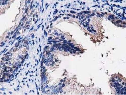 Immunohistochemistry PEPD Antibody (OTI5D5)