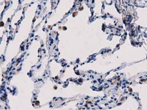 Immunohistochemistry PEPD Antibody (OTI5D5)