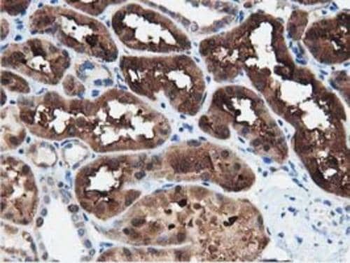 Immunohistochemistry PEPD Antibody (OTI5D5)
