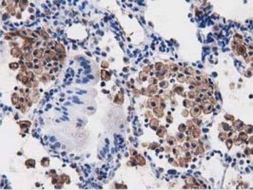 Immunohistochemistry PEPD Antibody (OTI5D5)