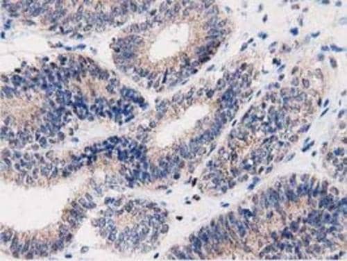Immunohistochemistry PEPD Antibody (OTI5D5)