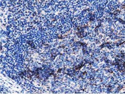 Immunohistochemistry PEPD Antibody (OTI5D5)