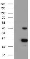 HEK293T cells were transfected with the pCMV6-ENTRY control (Left lane) or pCMV6-ENTRY PECI (, Right lane) cDNA for 48 hrs and lysed. Equivalent amounts of cell lysates (5 ug per lane) were separated by SDS-PAGE and immunoblotted with anti-PECI. 