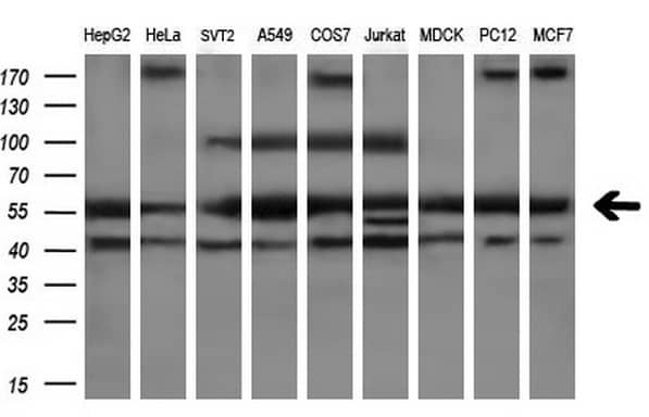 Western Blot PEPD Antibody (OTI5D5)