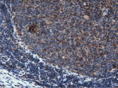 Immunohistochemistry PEPD Antibody (OTI1B7)