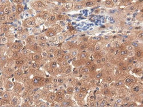 Immunohistochemistry PEPD Antibody (OTI1B7)