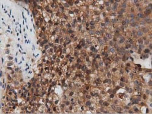 Immunohistochemistry PEPD Antibody (OTI1B7)