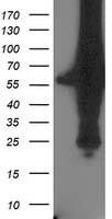HEK293T cells were transfected with the pCMV6-ENTRY control ( Left lane) or pCMV6-ENTRY XPNPEP3 ( Right lane) cDNA for 48 hrs and lysed. Equivalent amounts of cell lysates (5 ug per lane) were separated by SDS-PAGE and immunoblotted with anti-XPNPEP3. Positive lysates