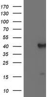 HEK293T cells were transfected with the pCMV6-ENTRY control (Left lane) or pCMV6-ENTRY PECI (, Right lane) cDNA for 48 hrs and lysed. Equivalent amounts of cell lysates (5 ug per lane) were separated by SDS-PAGE and immunoblotted with anti-PECI. 