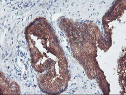 Immunohistochemical staining of paraffin-embedded Human prostate tissue within the normal limits using anti-PECI mouse monoclonal antibody. Heat-induced epitope retrieval by EDTA solution buffer pH 8.0 at 120Â°C for 3 min.