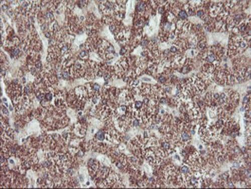 Immunohistochemical staining of paraffin-embedded Human liver tissue within the normal limits using anti-PECI mouse monoclonal antibody. Heat-induced epitope retrieval by EDTA solution buffer pH 8.0 at 120Â°C for 3 min.