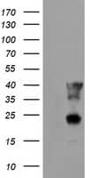 HEK293T cells were transfected with the pCMV6-ENTRY control ( Left lane) or pCMV6-ENTRY PECI ( Right lane) cDNA for 48 hrs and lysed. Equivalent amounts of cell lysates (5 ug per lane) were separated by SDS-PAGE and immunoblotted with anti-PECI Positive lysates