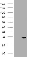 HEK293T cells were transfected with the pCMV6-ENTRY control (Left lane) or pCMV6-ENTRY CRYGC (, Right lane) cDNA for 48 hrs and lysed. Equivalent amounts of cell lysates (5 ug per lane) were separated by SDS-PAGE and immunoblotted with anti-CRYGC. 