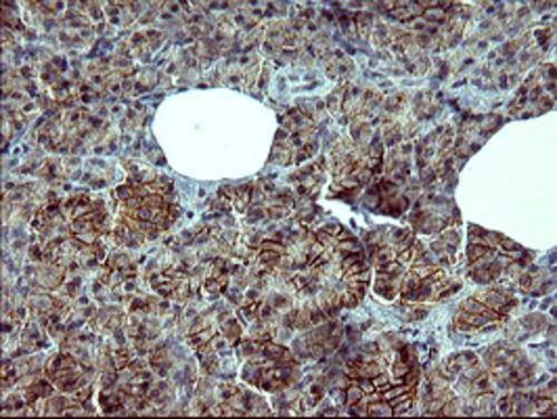 Immunohistochemical staining of paraffin-embedded Human pancreas tissue within the normal limits using anti-TH mouse monoclonal antibody. . Heat-induced epitope retrieval by EDTA solution buffer pH 8.0 at 120Â°C for 3 min.