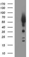 HEK293T cells were transfected with the pCMV6-ENTRY control ( Left lane) or pCMV6-ENTRY TH ( Right lane) cDNA for 48 hrs and lysed. Equivalent amounts of cell lysates (5 ug per lane) were separated by SDS-PAGE and immunoblotted with anti-TH. Positive lysates