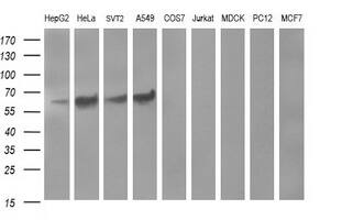 Western blot analysis of extracts (35ug) from 9 different cell lines by using anti-TH monoclonal antibody (HepG2: human; HeLa: human; SVT2: mouse; A549: human; COS7: monkey; Jurkat: human; MDCK: canine; PC12: rat; MCF7: human). Dilution: 1:400