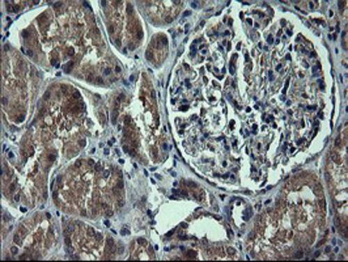 Immunohistochemical staining of paraffin-embedded Human Kidney tissue within the normal limits using anti-TH mouse monoclonal antibody. . Heat-induced epitope retrieval by EDTA solution buffer pH 8.0 at 120Â°C for 3 min.