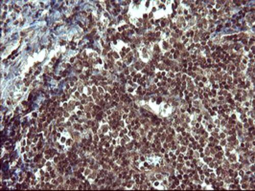 Immunohistochemical staining of paraffin-embedded Human lymph node tissue within the normal limits using anti-TH mouse monoclonal antibody. . Heat-induced epitope retrieval by EDTA solution buffer pH 8.0 at 120Â°C for 3 min.