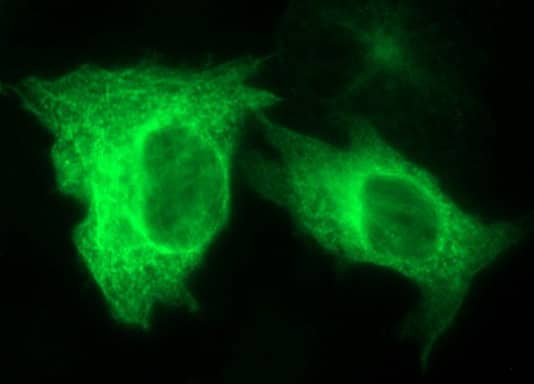 Anti-TUBB2A mouse monoclonal antibody immunofluoreaining of COS7 cells transiently transfected by pCMV6-ENTRY TUBB2A .