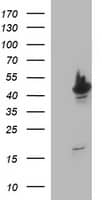 HEK293T cells were transfected with the pCMV6-ENTRY control ( Left lane) or pCMV6-ENTRY TUBB2A ( Right lane) cDNA for 48 hrs and lysed. Equivalent amounts of cell lysates (5 ug per lane) were separated by SDS-PAGE and immunoblotted with anti-TUBB2A. Positive lysates